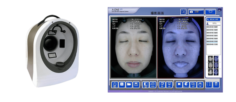 A-ONE（エー・ワン）の本体と肌診断の結果画面