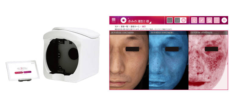 re-Beau2（レビュー2）の本体と肌診断の結果画面