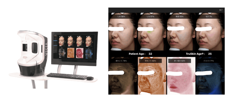 VISIA（ビジア）の本体と肌診断の結果画面