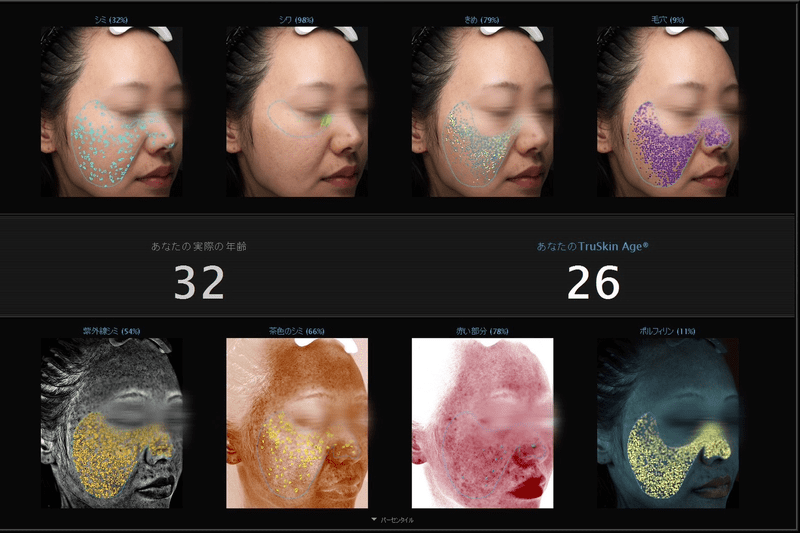 【体験レポ】話題のキュウエンクリニックの肌診断を受けてみた