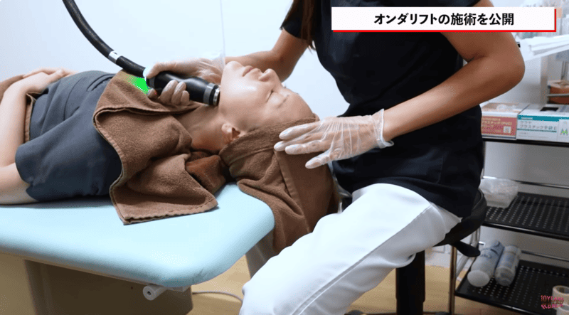 オンダリフト施術写真